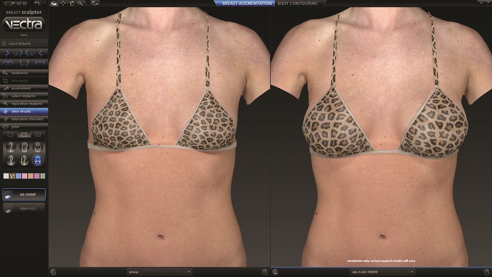 Breast Augmentation and Breast lift in Sydney Australia